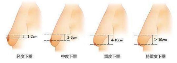 傅园慧弹泳衣视频_奶大都弹到泳衣外了_奶大露出泳衣外