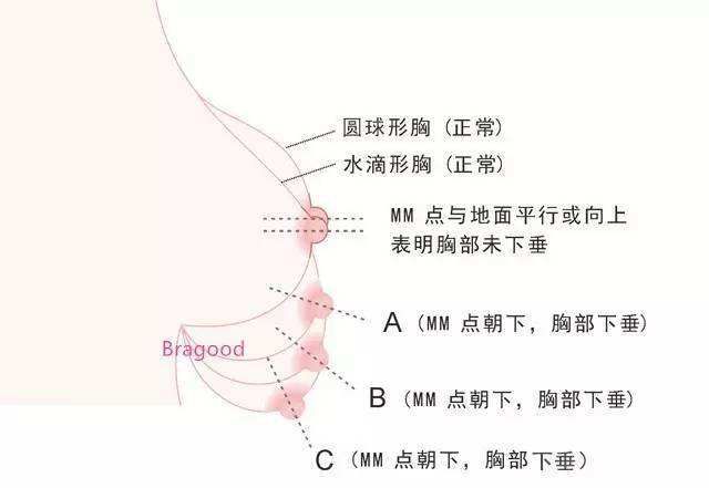 奶大都弹到泳衣外了_傅园慧弹泳衣视频_奶大露出泳衣外