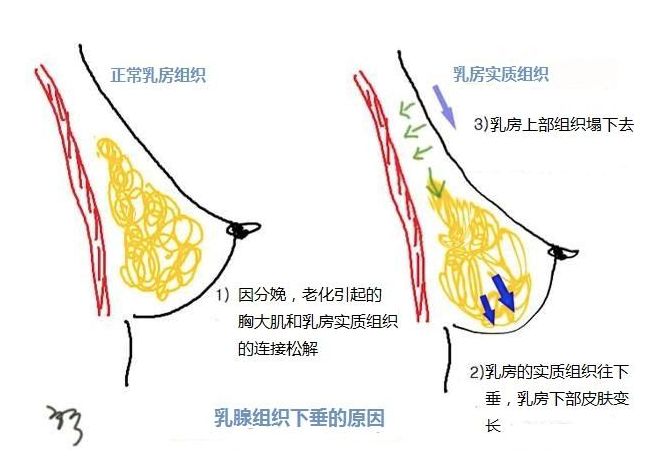 奶大都弹到泳衣外了_奶大露出泳衣外_傅园慧弹泳衣视频