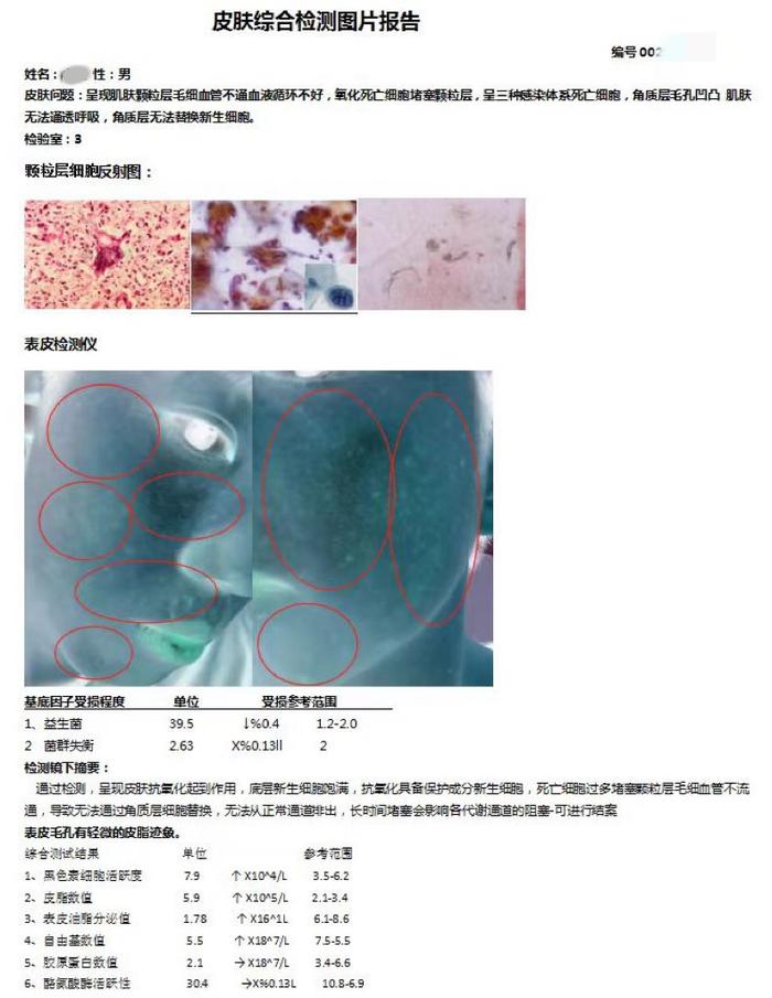 “护肤老师”发送给小江的皮肤检测图片报告。受访者供图